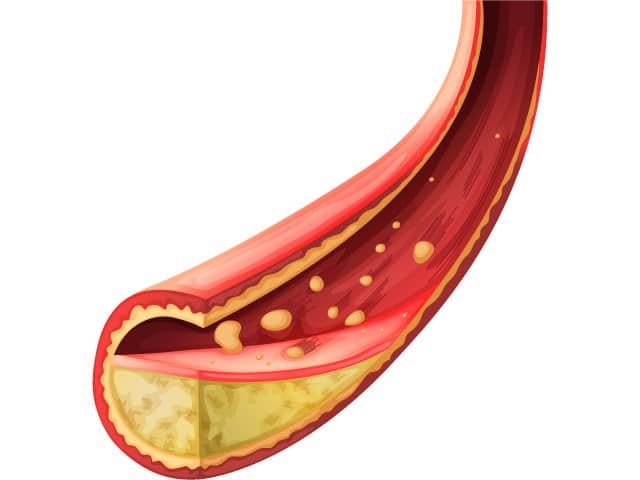 สาหร่ายแดง แอสตาแซนธิน astaxanthin ป้องกันทางไขมันในเลือด